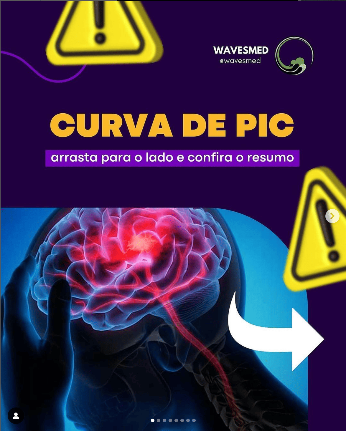 CURVAS DE PRESSÃO INTRACRANIANA