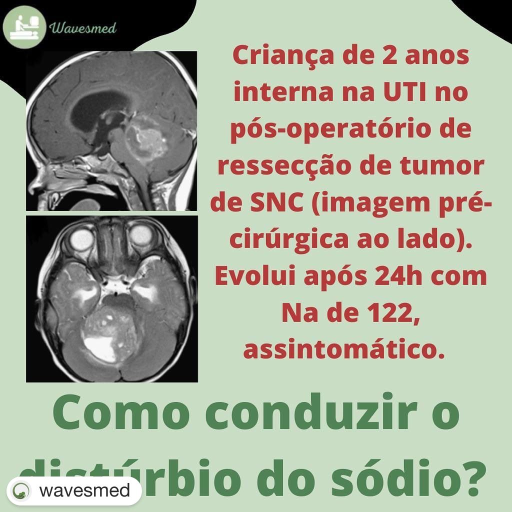 Como conduzir distúrbios do Sódio