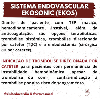 Ekos TEP Maciço Trombólise Wavesmed