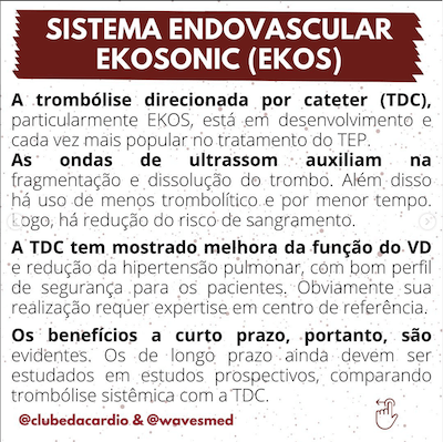 Trombólise Direcionada Cateter TEP Maciço Trombólise Wavesmed