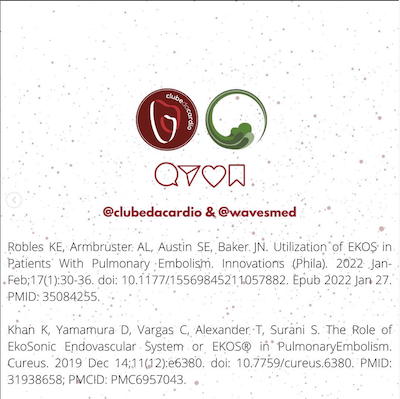 Clube da cardio TEP Macico Trombolise Wavesmed