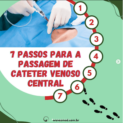 7 Passos para passagem cateter venoso central Wavesmed