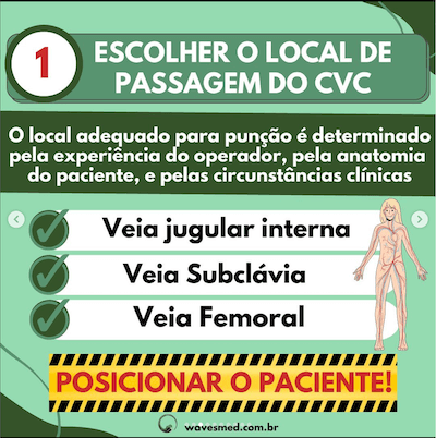 Local 7 passos para passagem cateter venoso central wavesmed