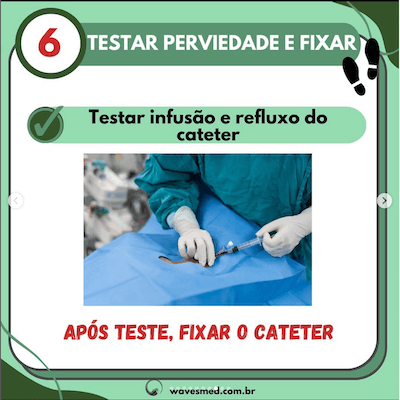 Testar 7 passos para passagem cateter venoso central Wavesmed