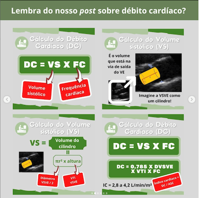 Debito Cardíaco medida da vsve tavr Wavesmed