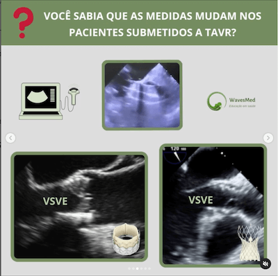 Medidas Medida da vsve tavr Wavesmed