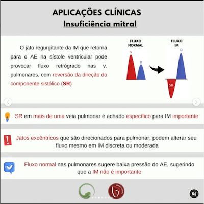 Aplicações clinicas insuficiência mitral ecocardiograma veias pulmonares wavesmed
