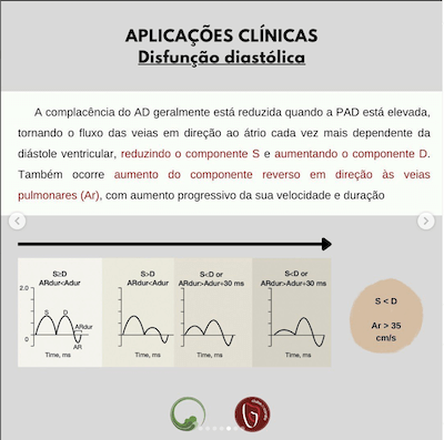 Disfunção diastólica ecocardiograma veias pulmonares Wavesmed