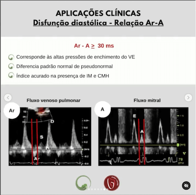 Relação a ar ecocardiograma veias pulmonares wavesmed