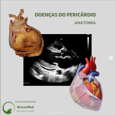 Anatomia do pericárdio Wavesmed
