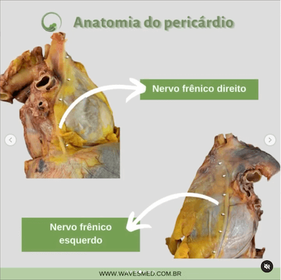 Nervo frênico anatomia do pericárdio Wavesmed