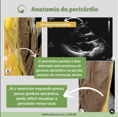 Pericárdio Parietal anatomia do pericárdio Wavesmed