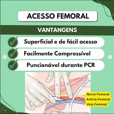 Acesso femoral cateter venoso central pediatria Wavesmed