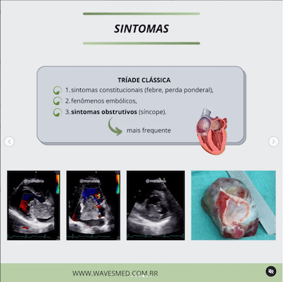 Sintomas mixoma Wavesmed