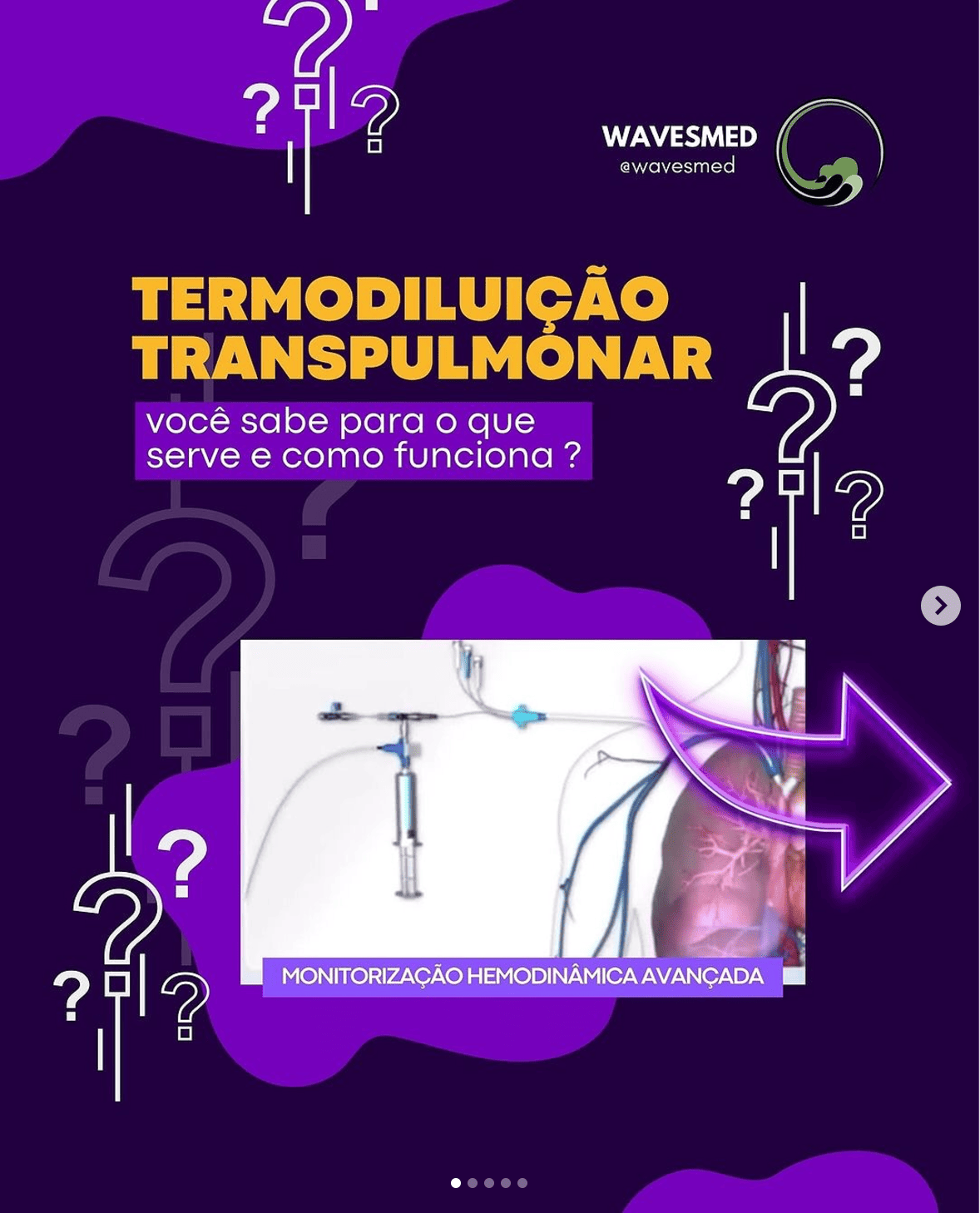 termodiluicao_transpulmonar