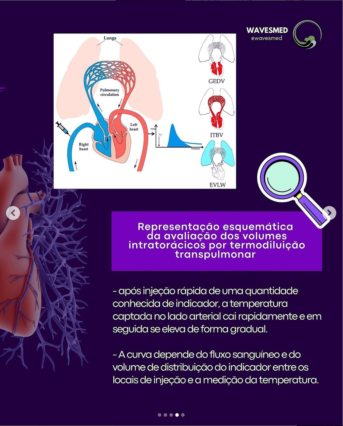 curva_TERMODILUIÇÃO_TRANSPULMONAR_Wavesmed