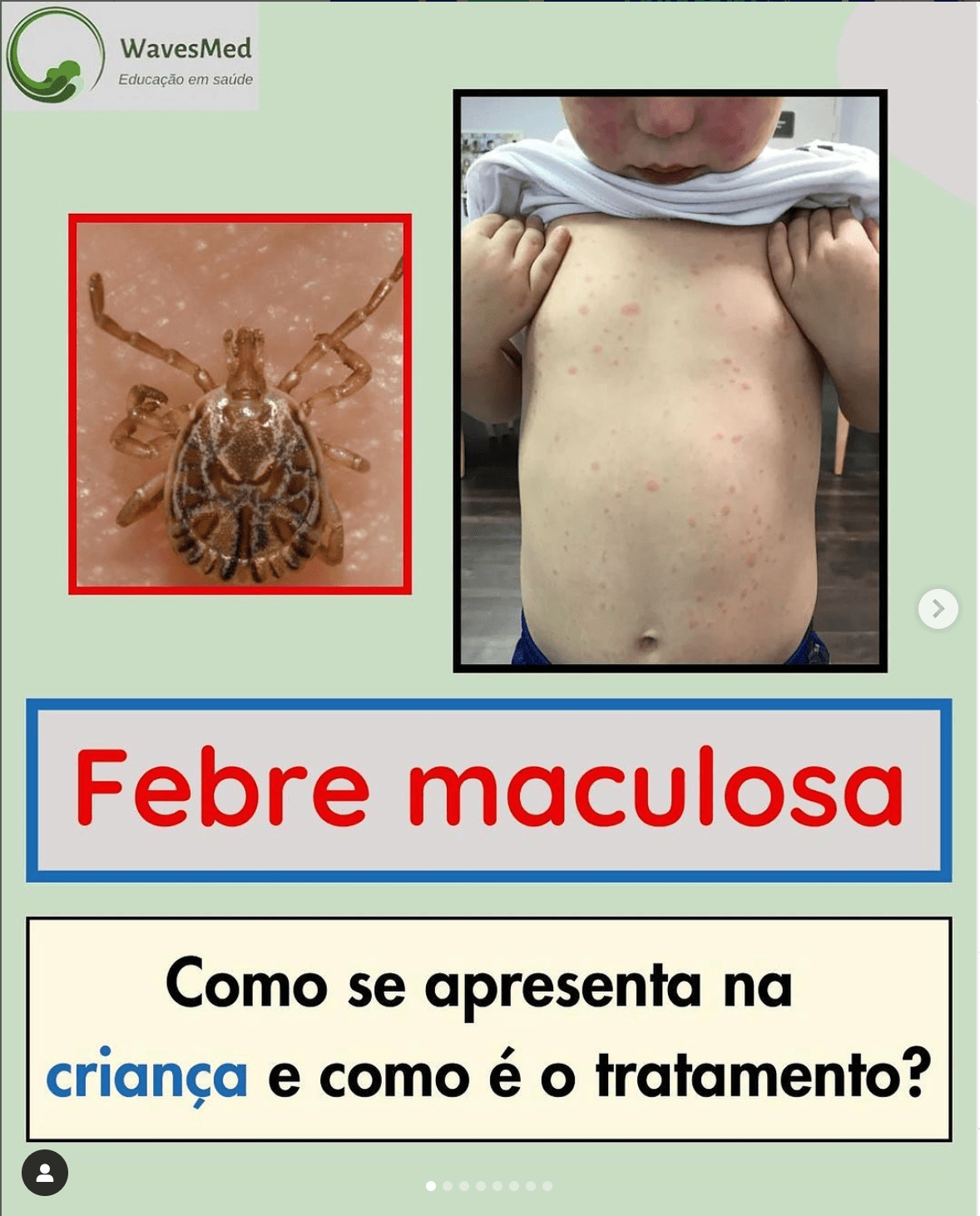Febre_Maculosa