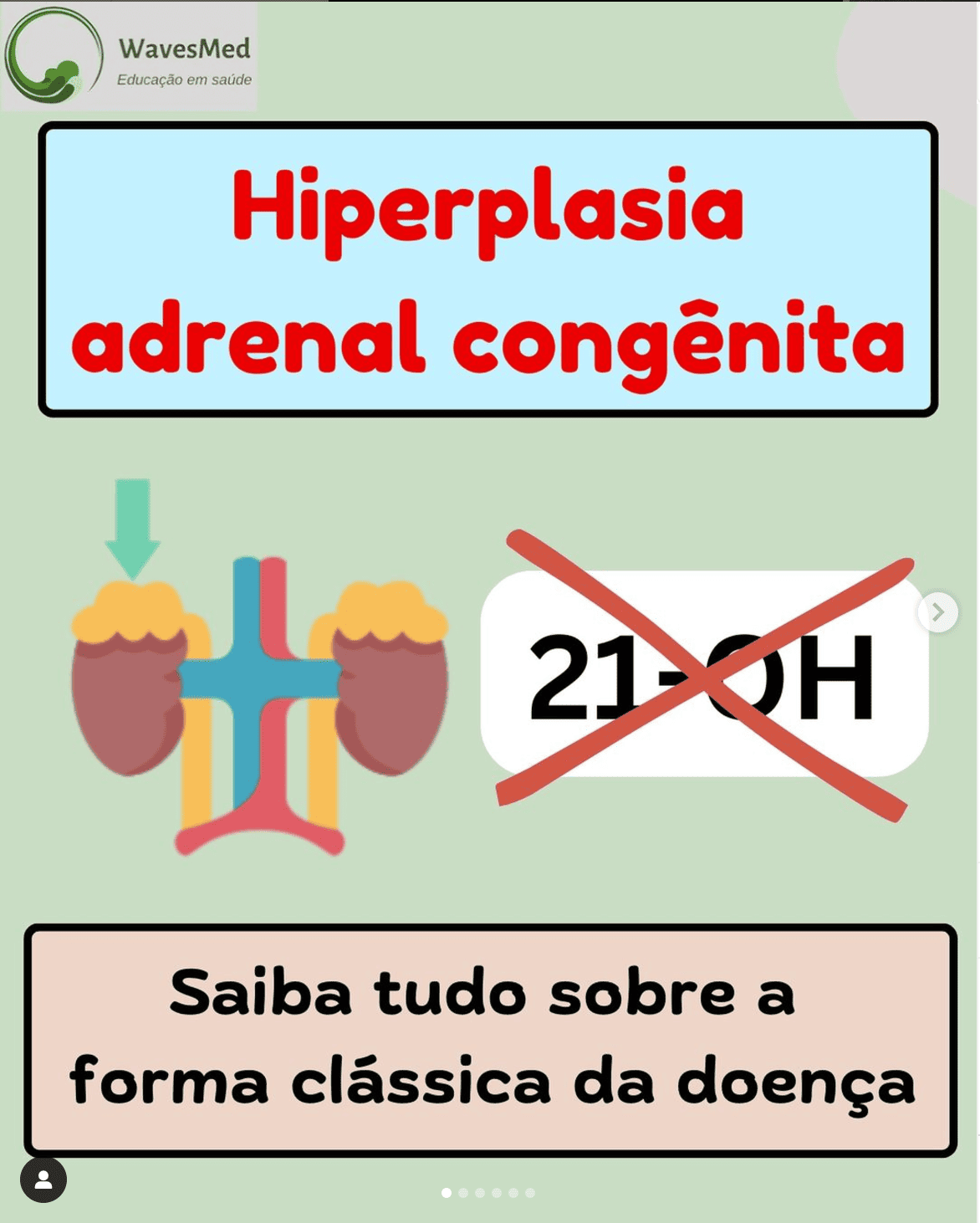 Hiperplasia Adrenal Congenita Wavesmed