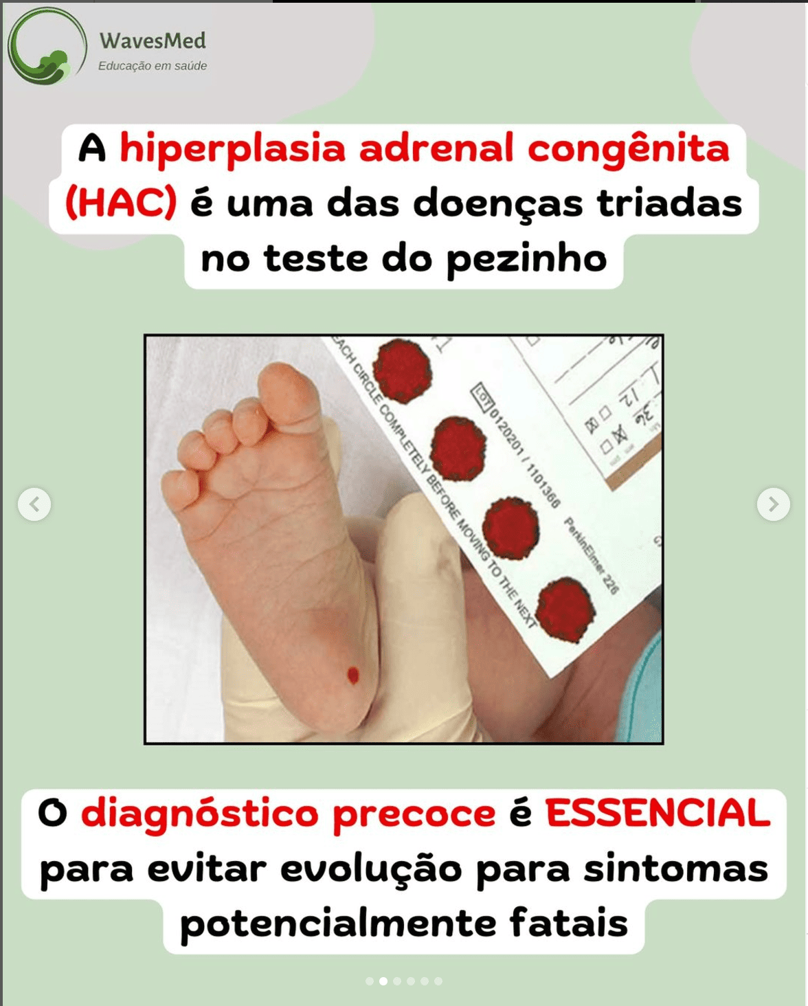 Definição Hiperplasia Adrenal Congenita Wavesmed