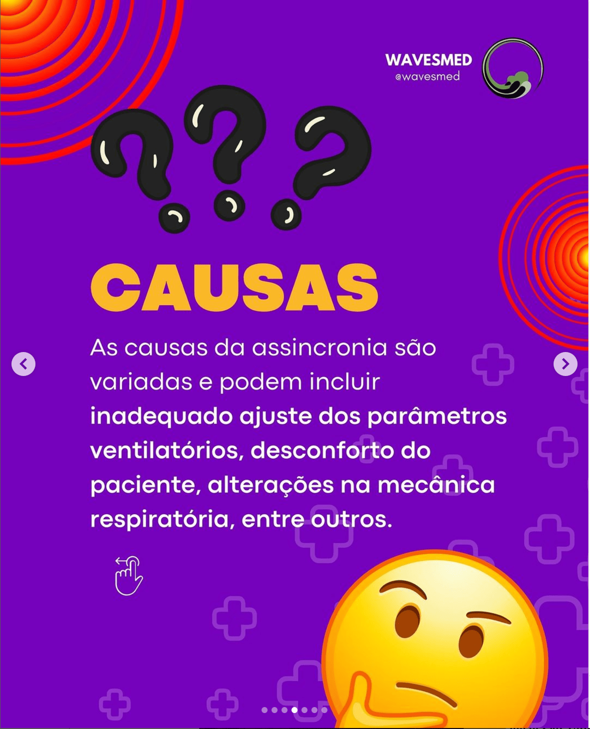 Causas Assincronia na ventilacao mecanica Wavesmed