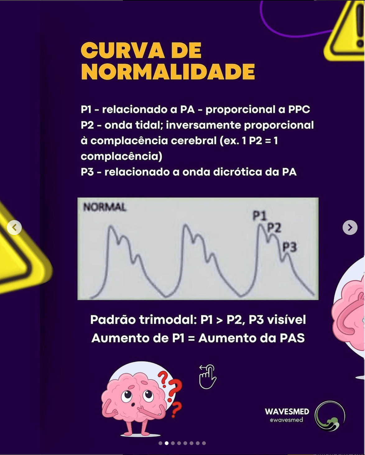 Curva normal pic curva de pressão intracraniana Wavesmed