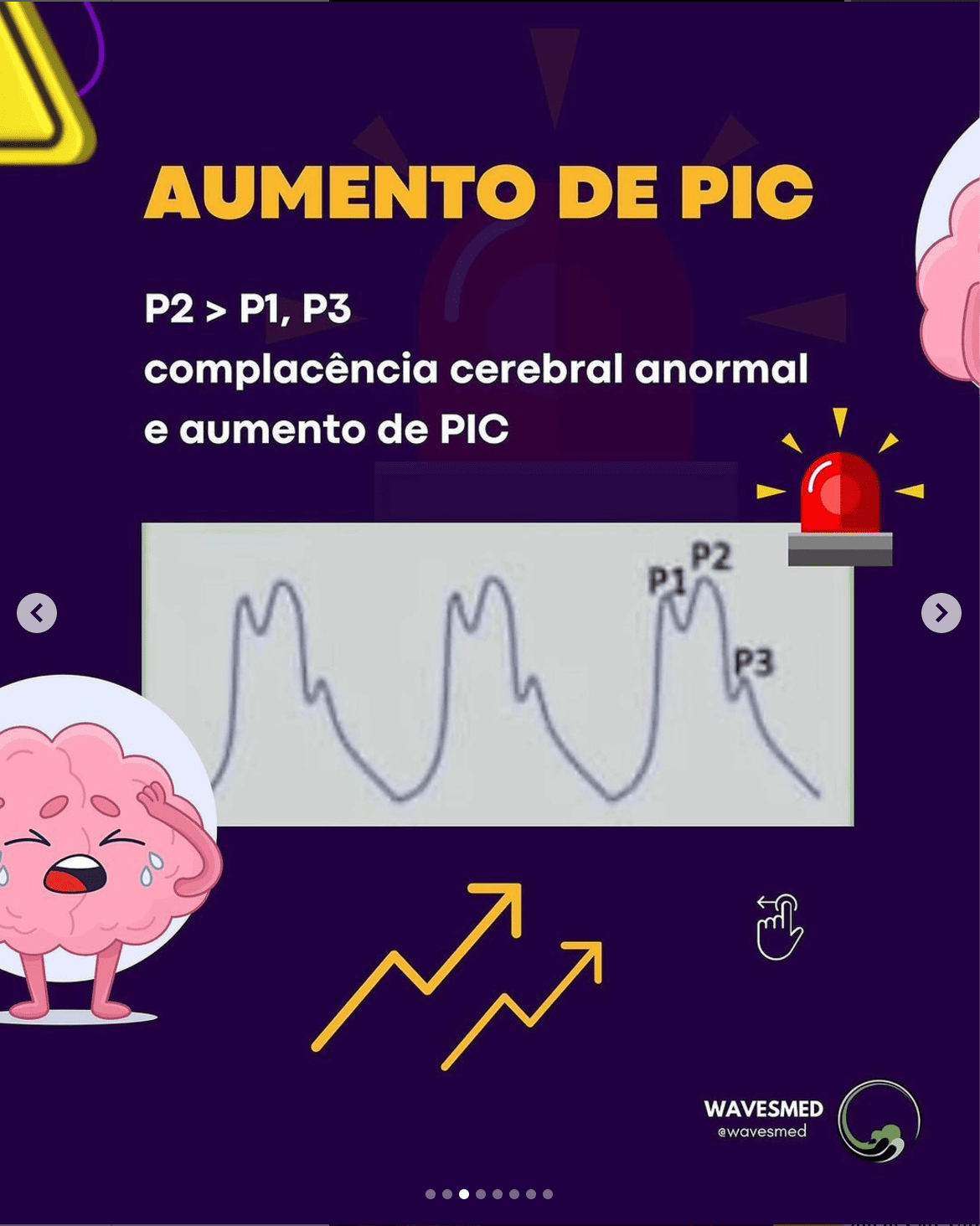 Aumento de pic curva de pressão intracraniana Wavesmed
