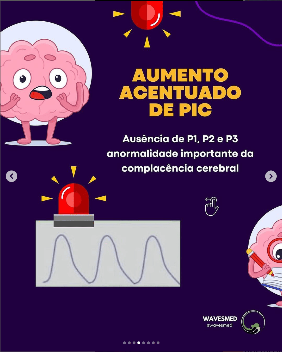 Aumento de pic curva de pressão intracraniana Wavesmed