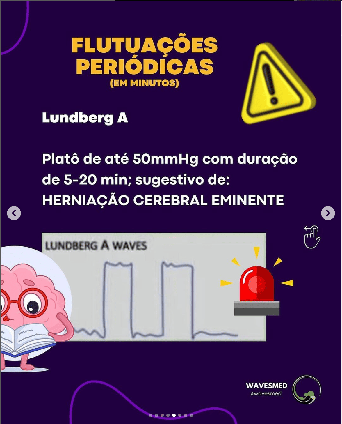 Aumento de pic curva de pressão intracraniana Wavesmed