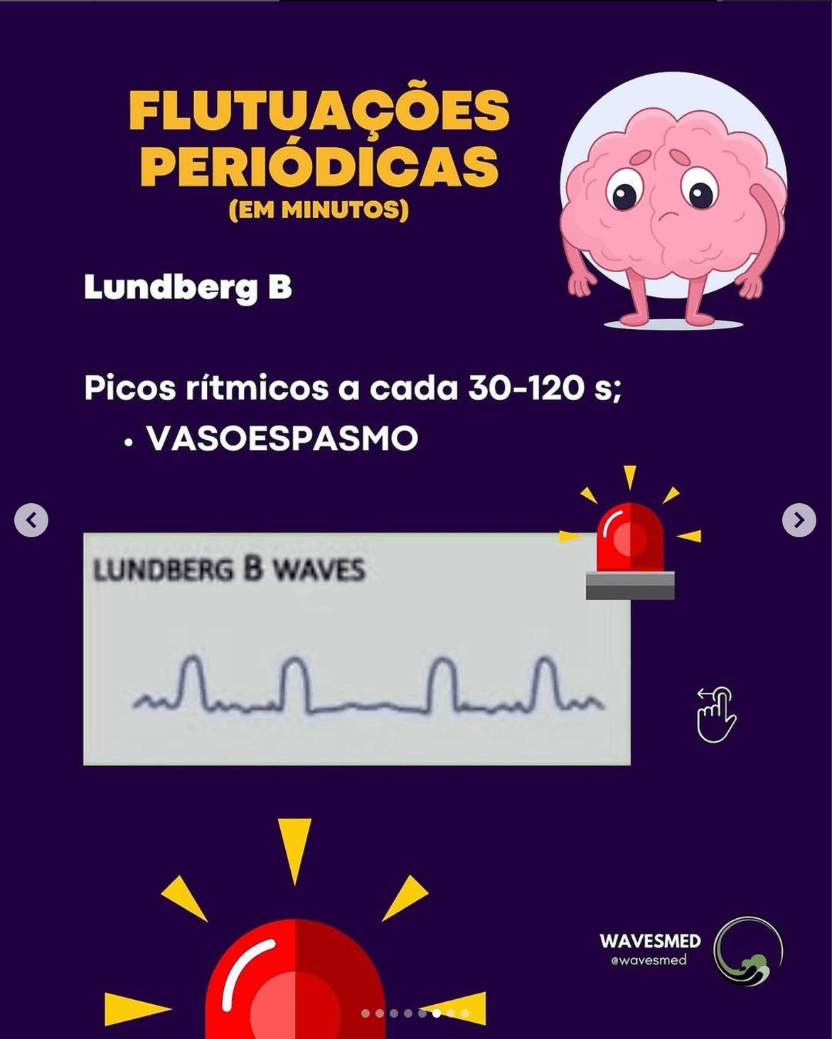 Lundberg b curva de pressão intracraniana Wavesmed