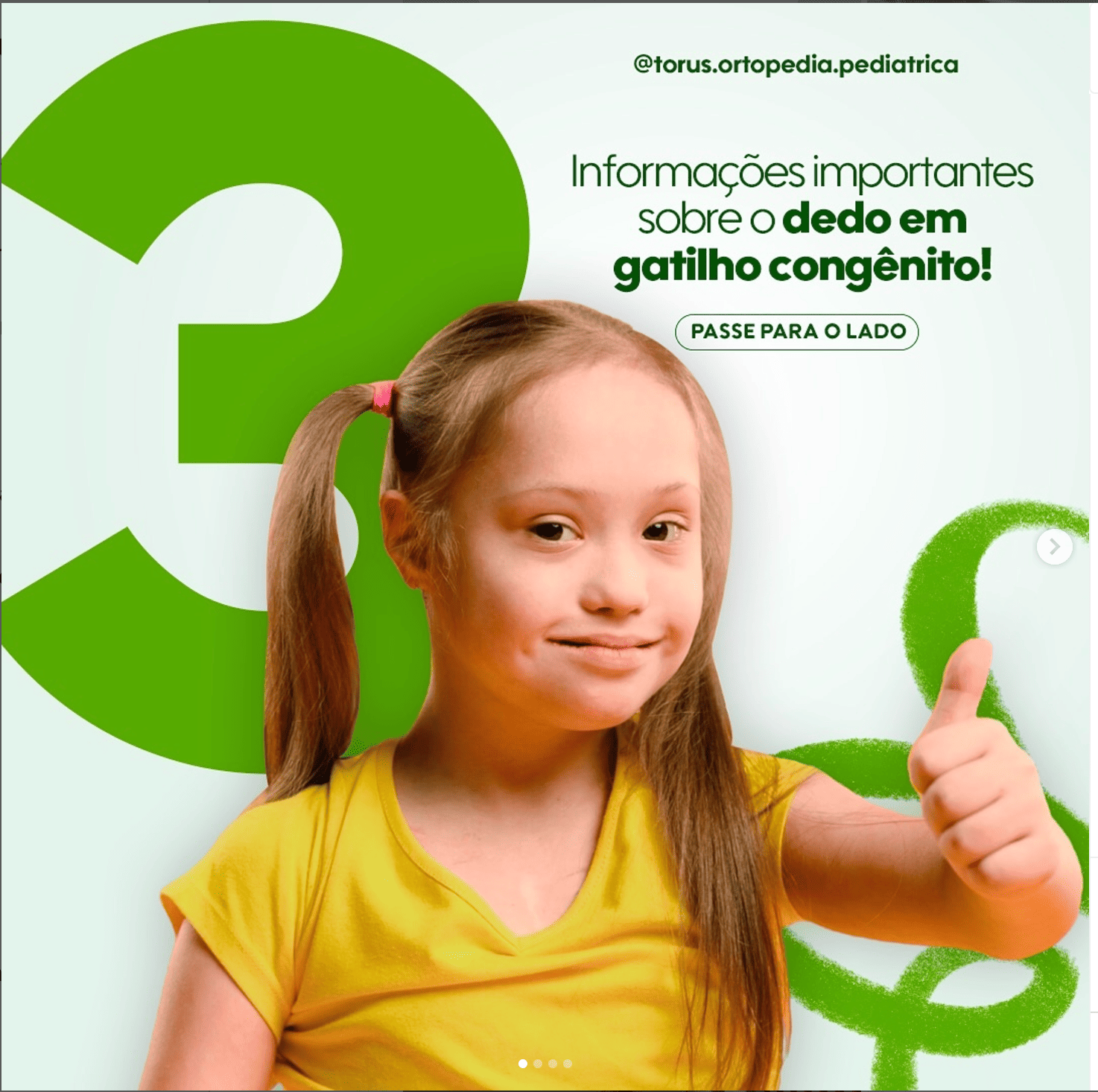 Dedo em gatilho congenito Wavesmed