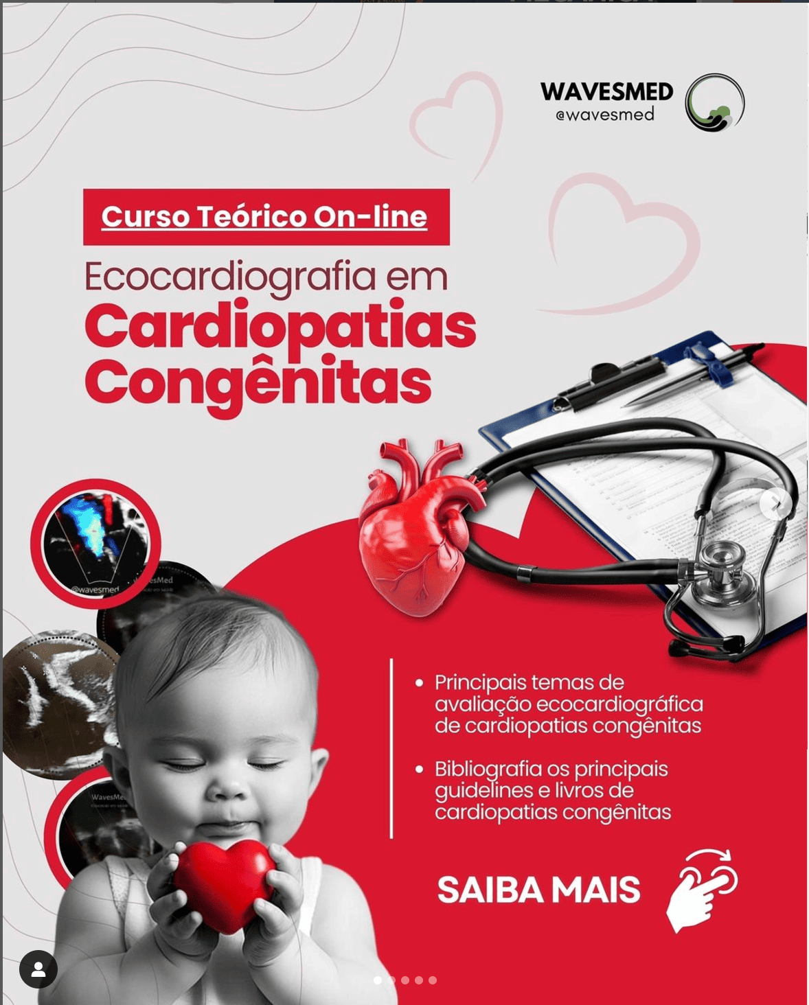Curso Teórico online Ecocardiografia em Cardiopatias Congênitas Wavesmed