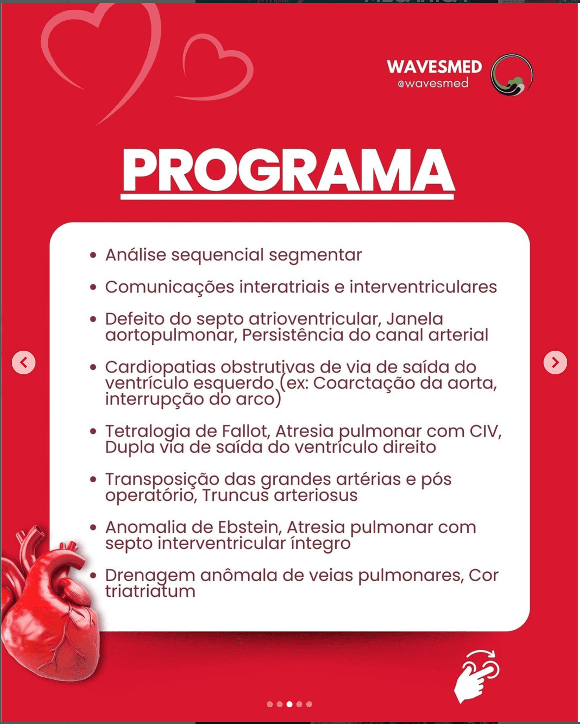 Cardiopatias cianogênicas curso teórico online ecocardiografia em cardiopatias congênitas Wavesmed