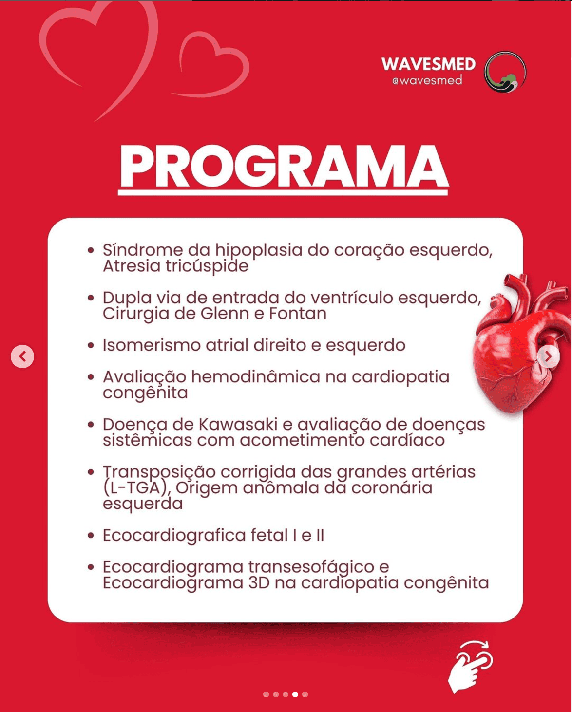 Cardiopatias univentriculares curso teórico online ecocardiografia em cardiopatias congênitas Wavesmed