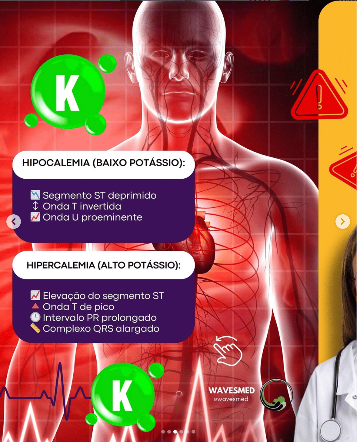 Potássio hipocalemia hipercalemia distúrbios eletrolíticos ECG Wavesmed
