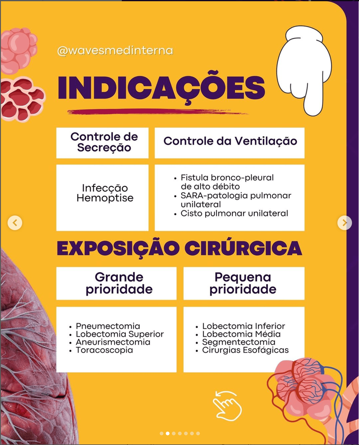 Indicações ventilação monopulmonar TEMI Wavesmed