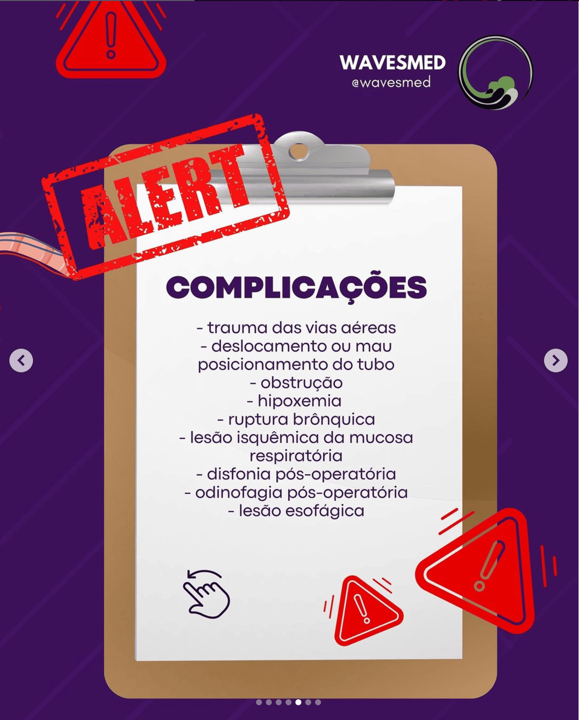 Complicações ventilação monopulmonar TEMI Wavesmed