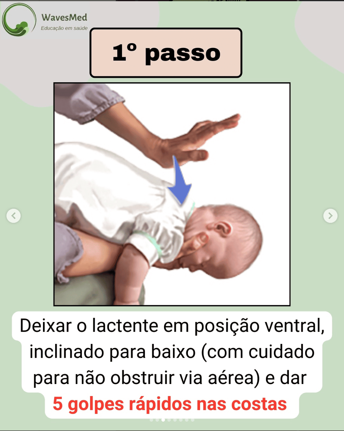 Posição ventral manobra desengasgo lactente Wavesmed
