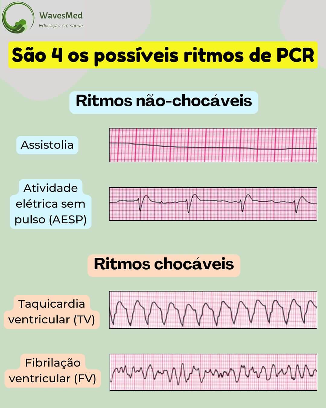 PCR- PALS TETIP Wavesmed
