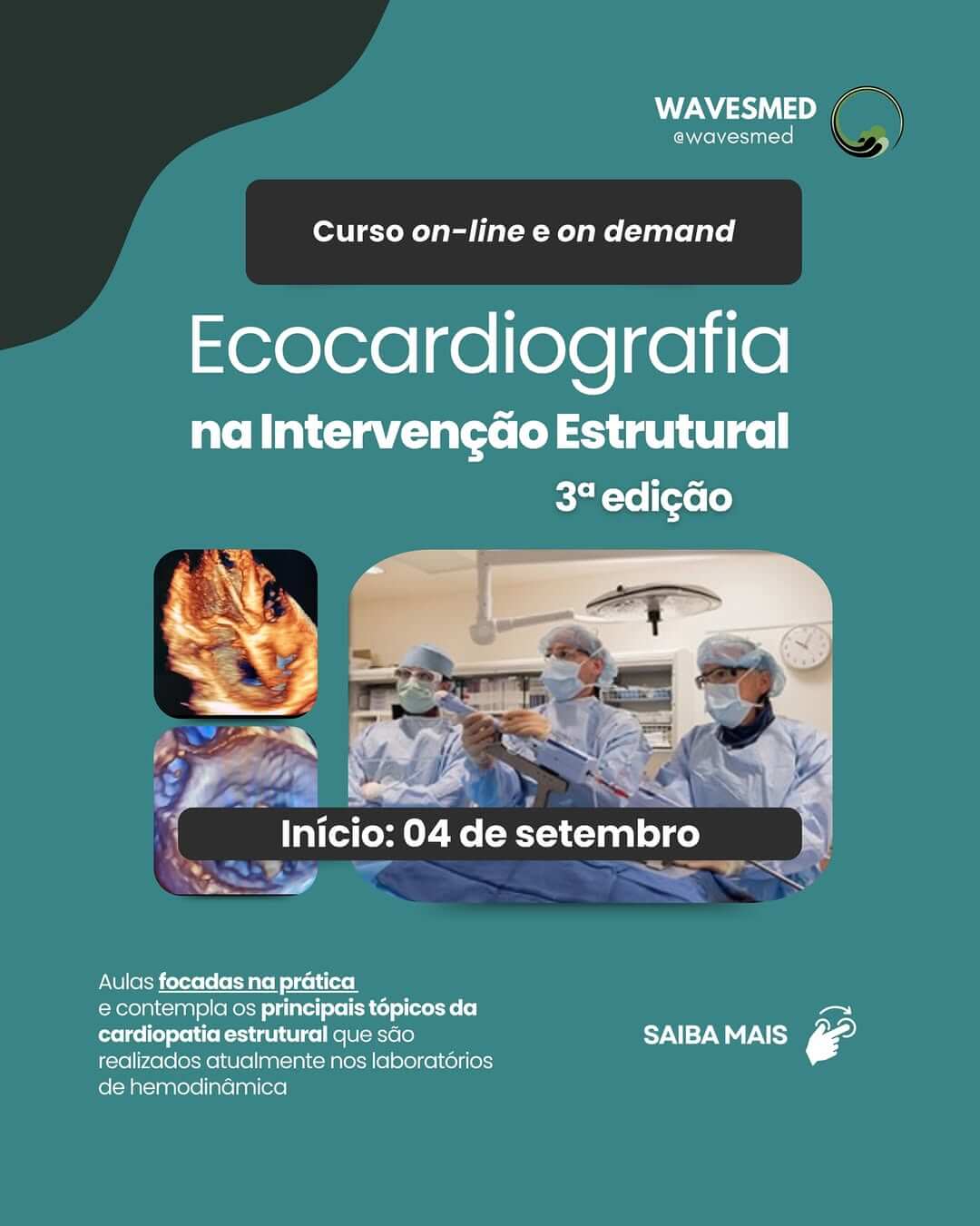 Curso Ecocardiografia na Intervenção Estrutural Wavesmed