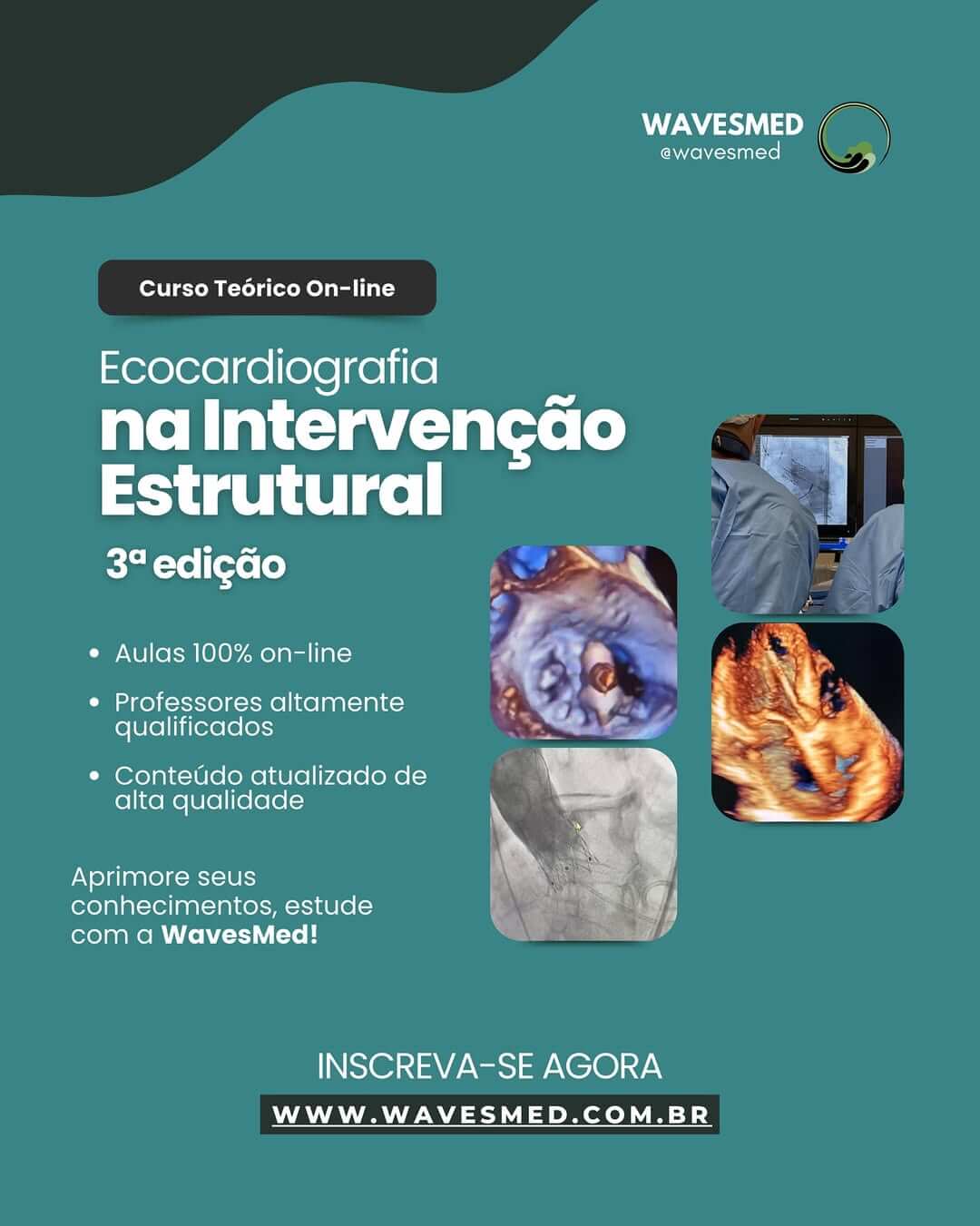 Curso Ecocardiografia na Intervenção Estrutural Wavesmed