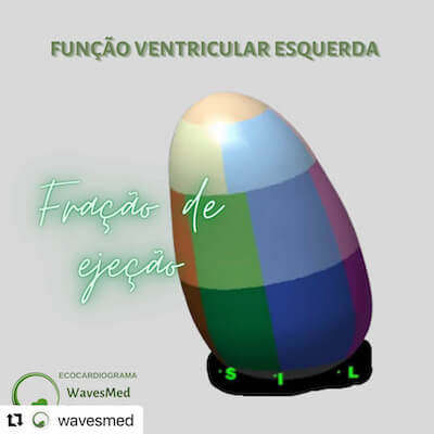Fração de Ejeção VE Wavesmed  Curso preparatorio para prova de título de ecocardiograma Wavesmed