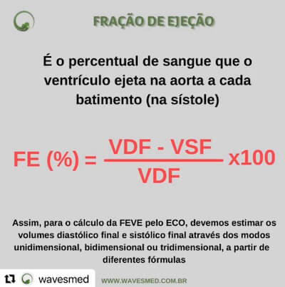 Fração de Ejeção VE Wavesmed  Método de Teicholz  Curso preparatorio para prova de título de ecocardiograma Wavesmed