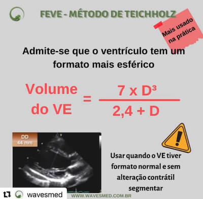 Fração de Ejeção VE Wavesmed  Teicholz  Curso preparatorio para prova de título de ecocardiograma Wavesmed