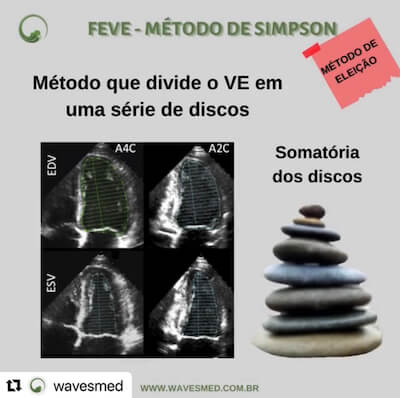 Fração de Ejeção VE Wavesmed  Método Simpson  Curso preparatorio para prova de título de ecocardiograma Wavesmed
