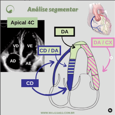 Função ventricular esquerda ecocardiograma  Análise coronária correspondente  Apical 4C