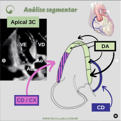 Função ventricular esquerda ecocardiograma  Análise coronária correspondente  Apical 3C
