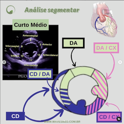 Função ventricular esquerda ecocardiograma Wavesmed  Análise coronária correspondente  Curto médio