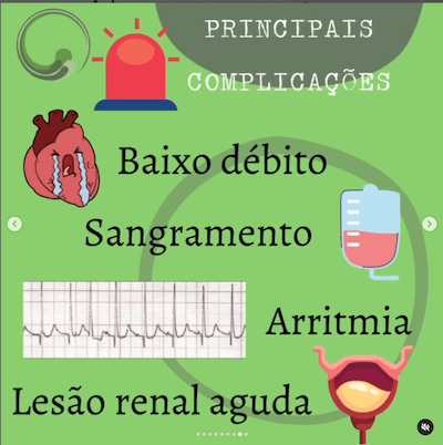 Pós operatório de cirurgia cardíaca pediátrica Wavesmed  Principais complicações