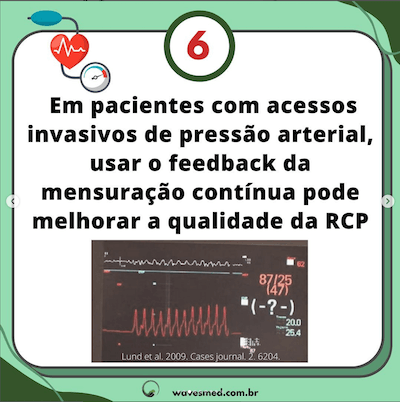 Pressão arterial invasiva  Atualizações PALS Parte 2 Wavesmed