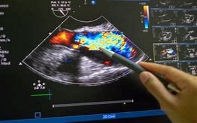 Videoteca em Ecocardiografia